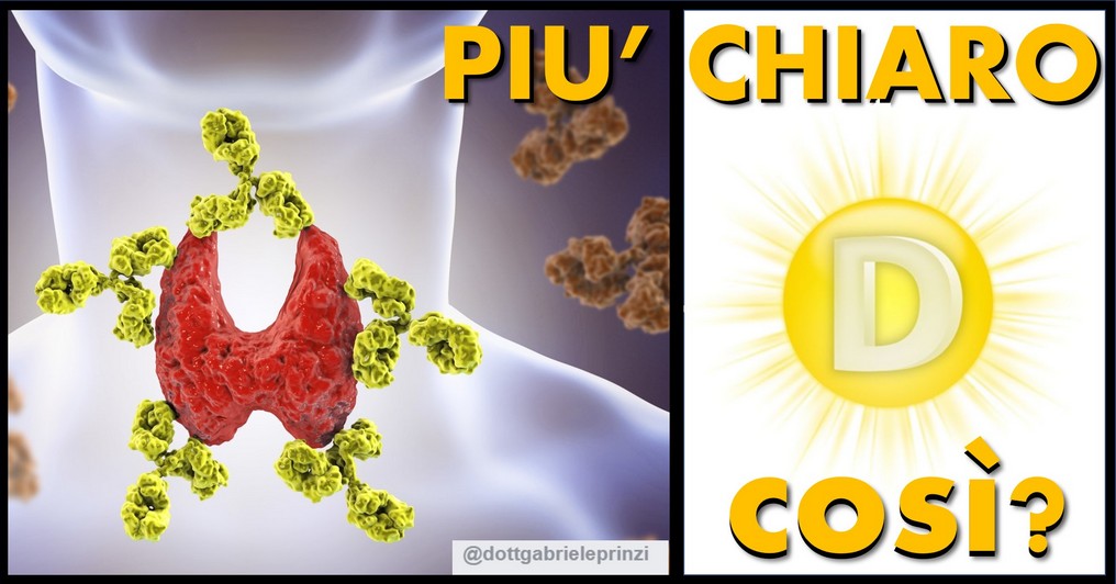 Bassi livelli di vitamina D sono associati alla Tiroidite di Hashimoto
