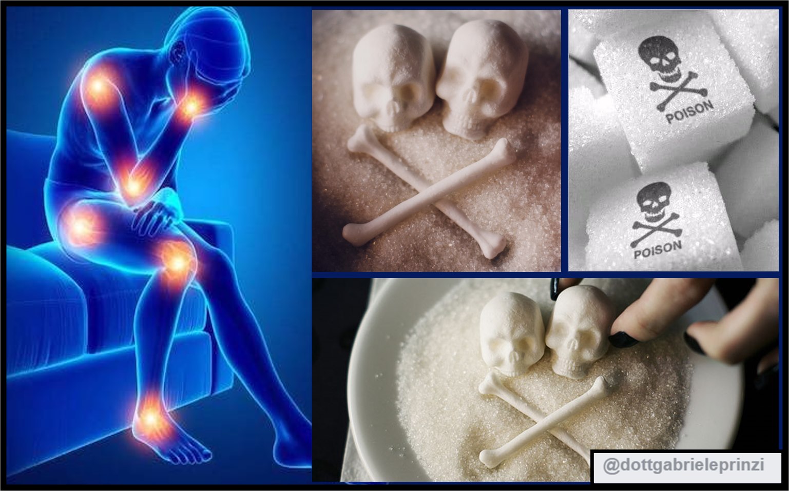 SINDROME FIBROMIALGICA E ZUCCHERI.