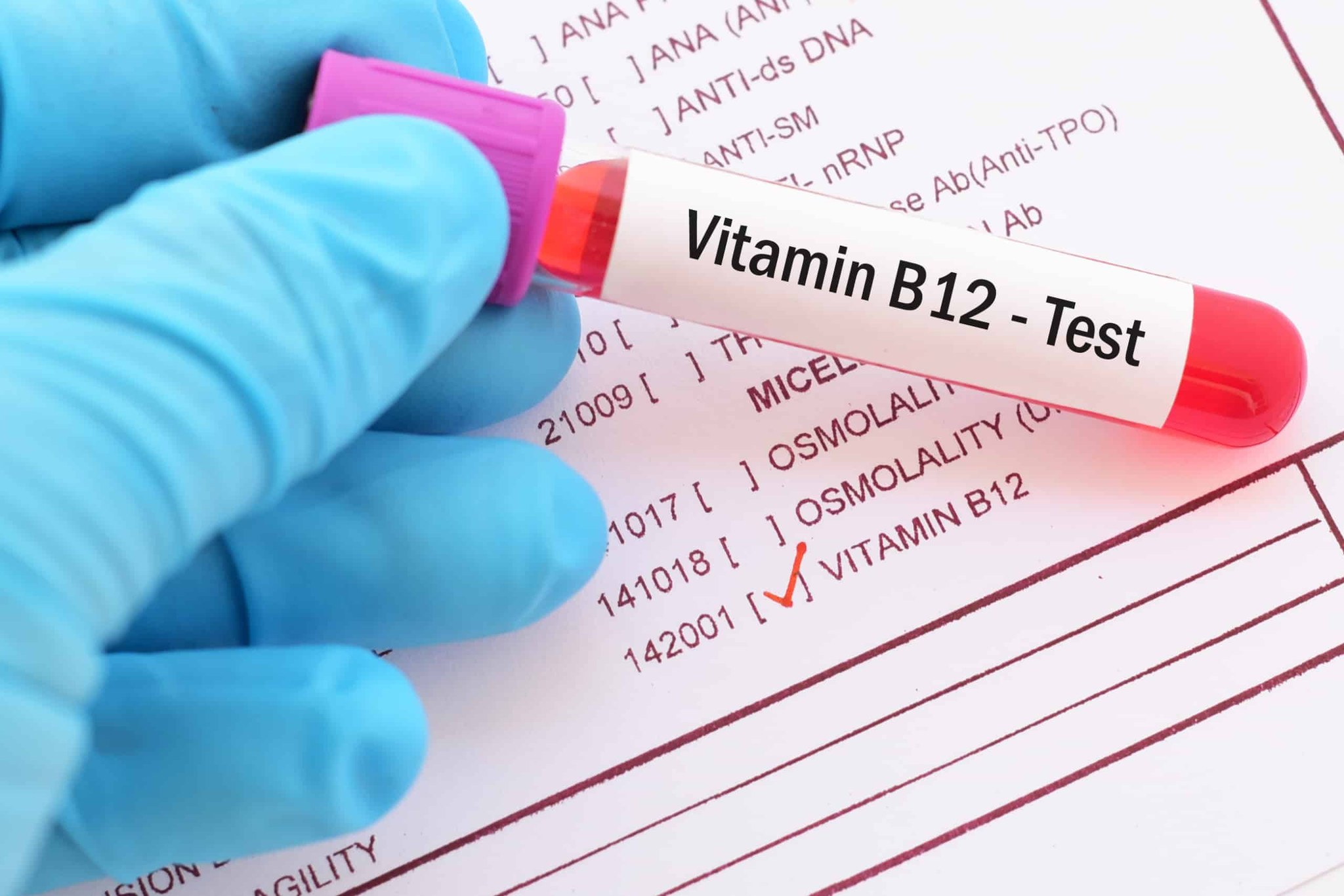 ANEMIA, NEUROPATIE E CARENZA DI FERRO. . MINI TRATTATO DELLA - DIMENTICATA - VITAMINA B12