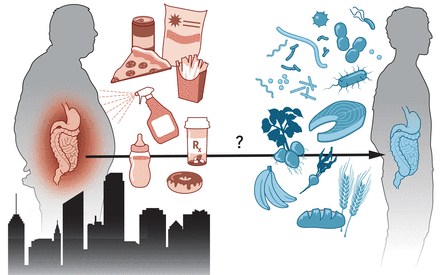 CROHN E RETTOCOLITE. MALATTIE INFIAMMATORIE CRONICHE DELL'INTESTINO